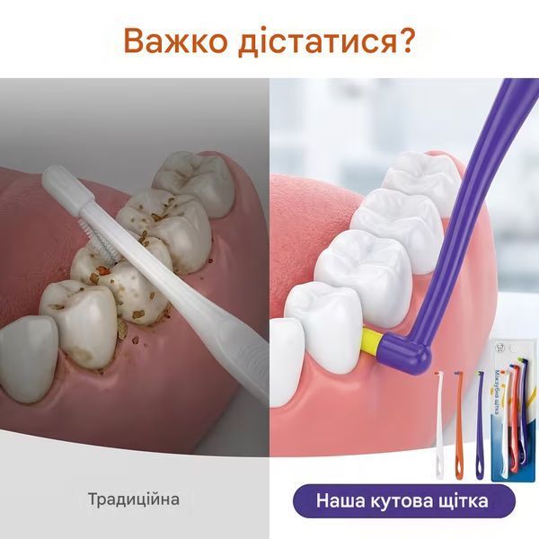Монопучкова зубна щітка INTERDENTAL BRUSH, набір 3 шт. для гігієни важкодоступних зон, для брекетів і імплантів 3127470908 фото